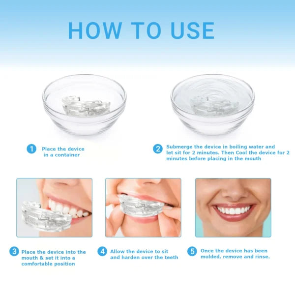 Anti Snore Mouthguard - Hot Sale 50% Off