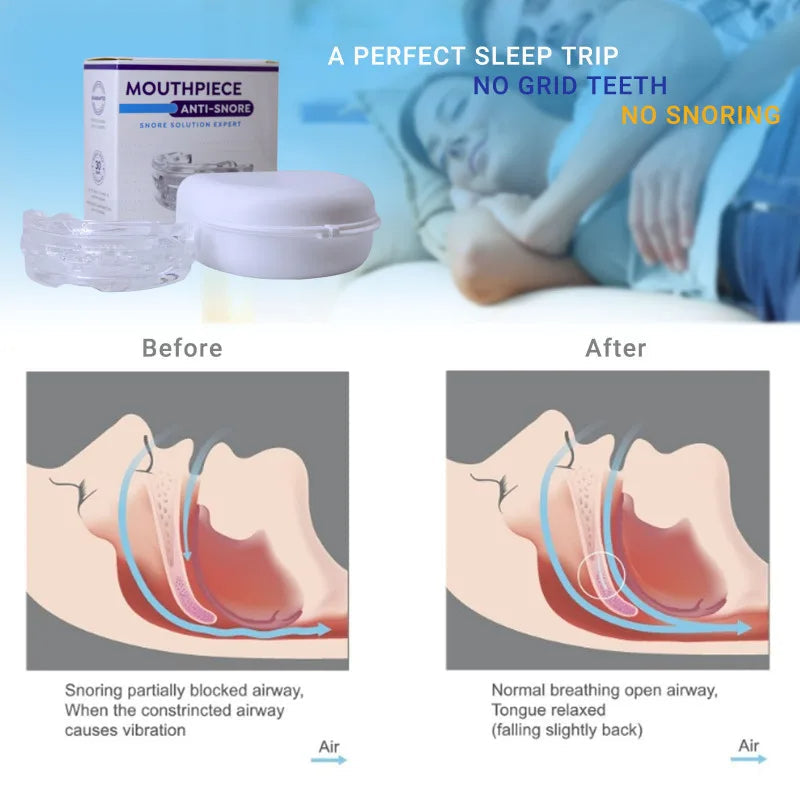 Z Comfort | Anti-snoring device - New Year Sale Off 60%